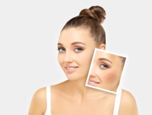 Tranexamic Acid in Cosmetics: A Game Changer for Skin Health